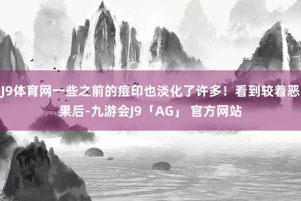 J9体育网一些之前的痘印也淡化了许多!看到较着恶果后-九游会J9「AG」 官方网站